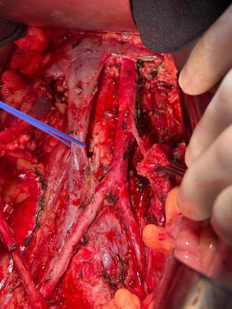 Robotic Surgery Console