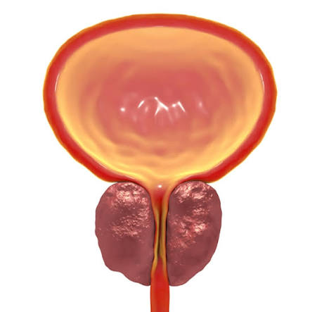 Enlarged Prostate